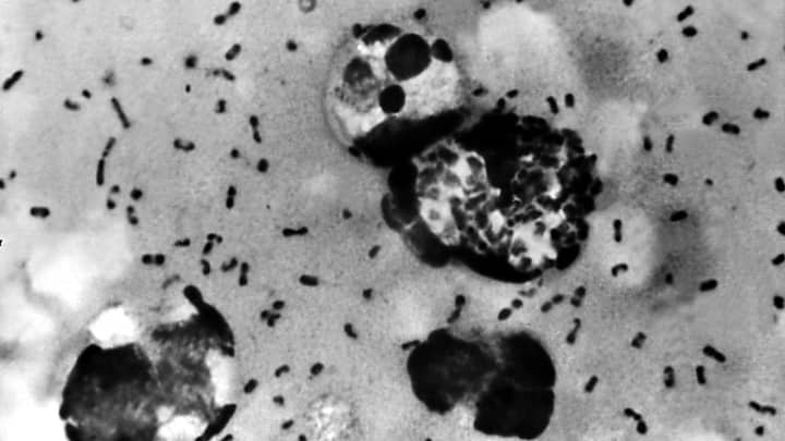 Our ancient enemy: scientists discover oldest-known plague outbreak