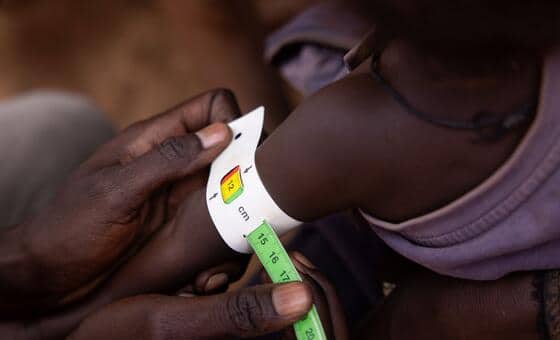 Worsening hunger could push millions closer to famine in 13 global hotspots