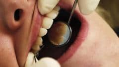 Patients of retired dentist warned of bloodborne viruses, including HIV